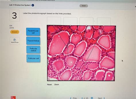 Label The Photomicrograph Based On The Hints Provided Solved Lab