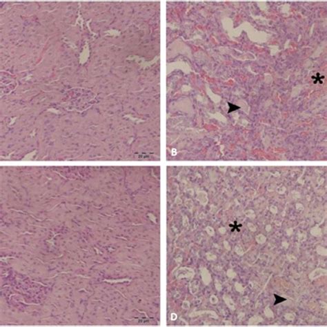 Histopathological Findings In Kidney Tissues A Control Group Normal