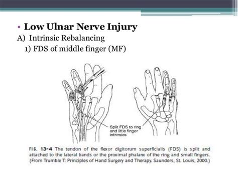 Pre And Post Operative Management In Tendon Transfer