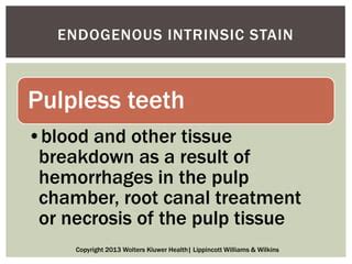 Dental Stains Discolorations And Polishing PPT