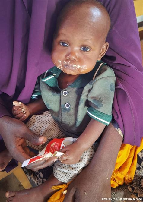 Combatting Malnutrition In Somalia Najmos Story Moas