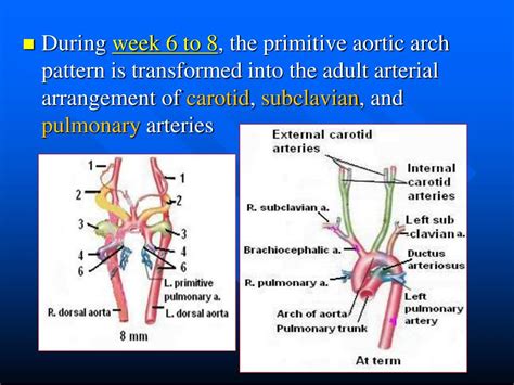 Ppt The Aortic Arches Powerpoint Presentation Free Download Id 2090347