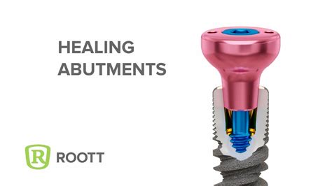 Healing Abutments R For ROOTT R Dental Implants YouTube