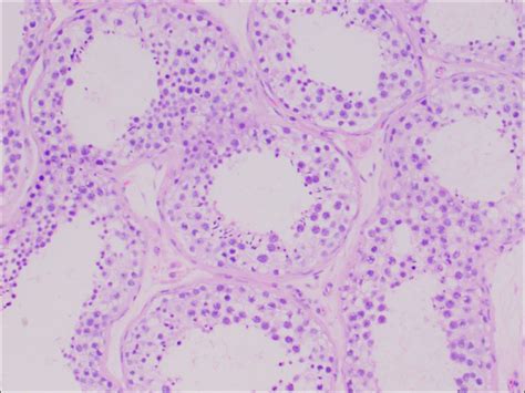 Testis And Epididymis Normal Histology Nus Pathweb Nus Pathweb