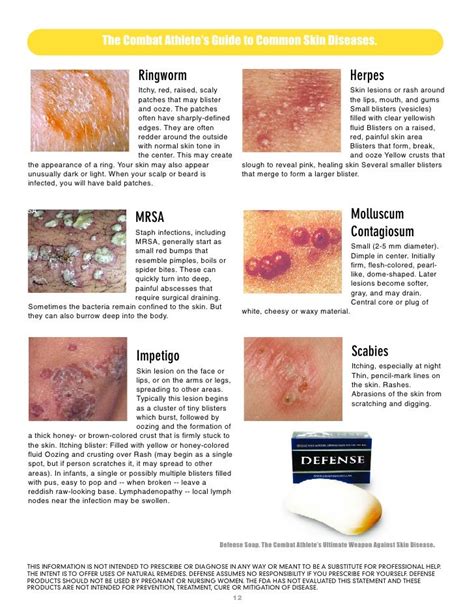 Identify Skin Lesions