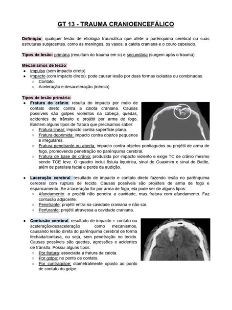 Trauma Cranioencefálico: Tipos e Tratamento | PDF | Traumatismo