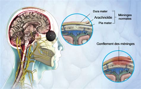 Health Condition Symptoms Causes Treatment And More