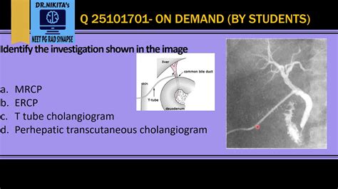 Ercp Vs Mrcp T Tube Cholangiogram Ptc Youtube