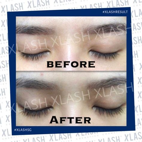 XLASH PRO Lash Serum 6ml - Xlash Cosmetics Singapore