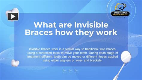 Ppt What Are Invisible Braces How They Work Smile Dental And