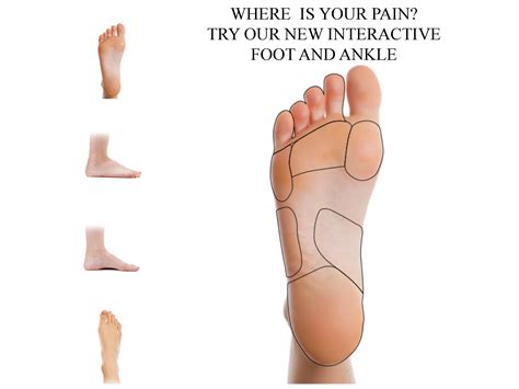 Ankle Foot Orthotic Centre Ankle And Foot Pain Centre Northcote