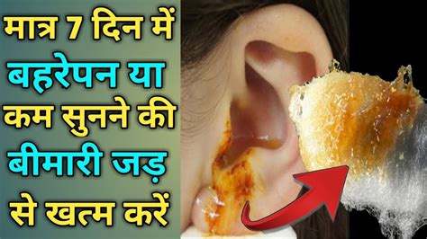 बहरेपन व कम सुनाई देने की बीमारी का पक्का ईलाज Get Rid Of Deafness