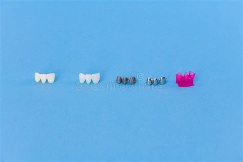 Different Types of Dental Tooth Crowns Stock Image - Image of closeup, dental: 163130337