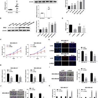 ERβ2 promoted TNBC cell migration and invasion by upregulation of