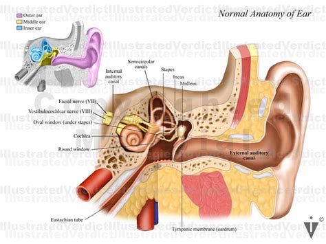 CASE AT A GLANCE: Inner Ear Balance / Relationship to Brain Anatomy — Illustrated Verdict