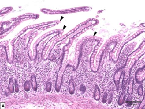 The morphology of the pterion and asterion sutures in Iranian population – European Journal of ...