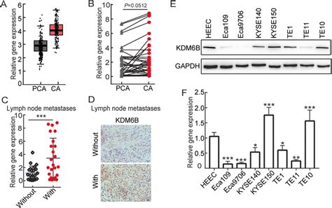 Kdm6b Expression Was Significantly Increased In Metastatic Escc A Tcga