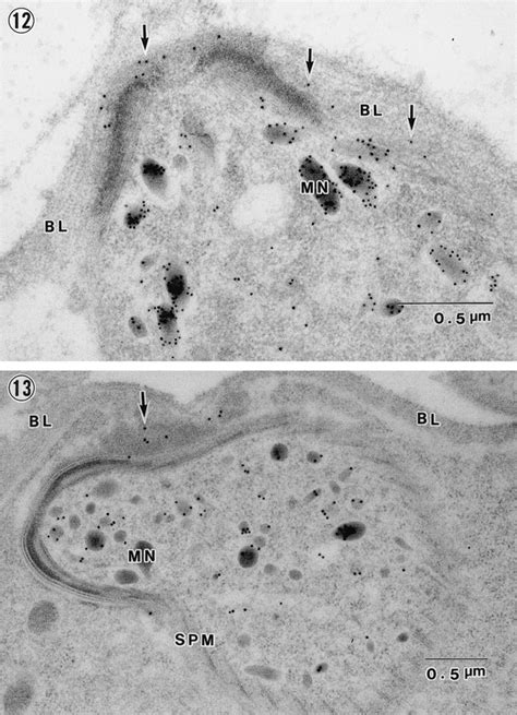 Immuno Electron Microscopic Observation Of Plasmodium Berghei Ctrp