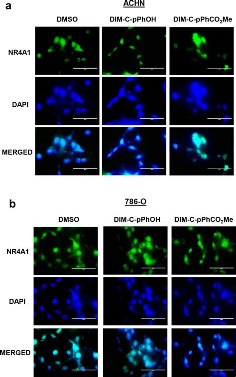 C-DIM/NR4A1 antagonists target nuclear NR4A1. ACHN (A) and 786-O (B ... 