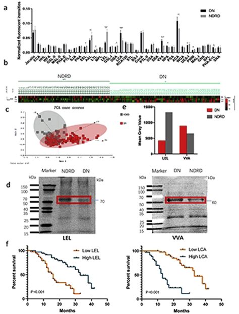 Pos Salivary Glycopatterns As Potential Non Invasive Biomarkers Of