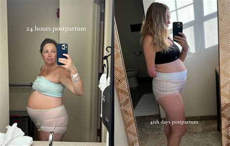 Sarah Herron Shares Realistic Postpartum Photos Of Her Belly After