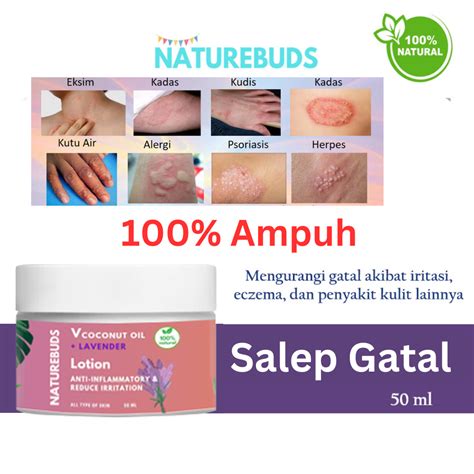 Salep Obat Gatal Paling Ampuh Alergi Eksim Jamur Merah Gigitan