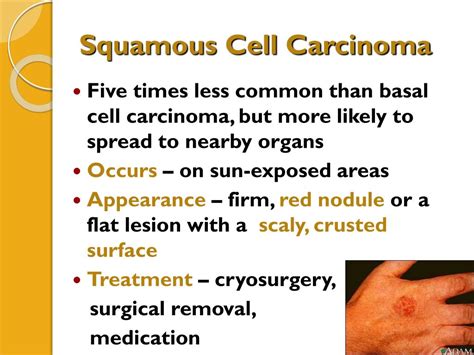 Ppt Integumentary System Part 2 Skin Disorders Powerpoint