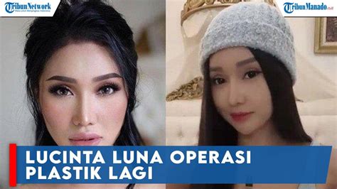 Lucinta Luna Operasi Plastik Lagi Sebut Kini Berubah Wujud Menjadi K