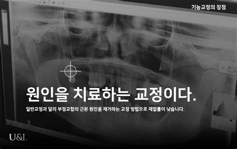 기능교정 유앤아이치과의원 압구정