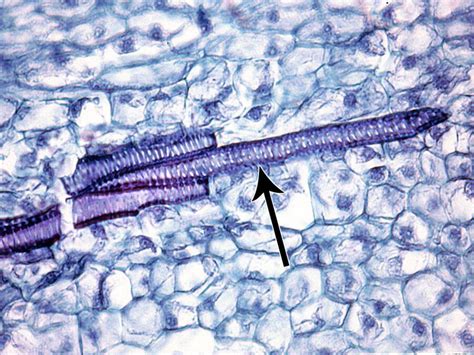 Cell Types, Xylem