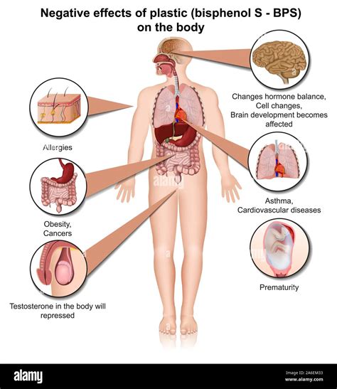 Bisfenol s efectos sobre el cuerpo humano en 3D medical ilustración