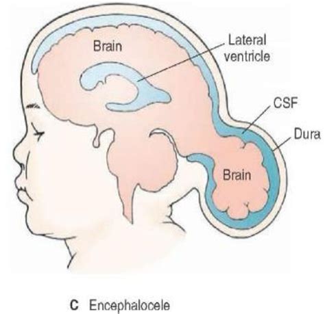 L1 Neuroembryology Flashcards Quizlet