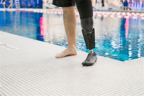 New Prosthesis From Northwell Health Propels Users Through The Water