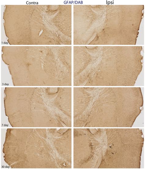 DAB Reacted GFAP Immunohistochemistry This Figure Depicts The Same