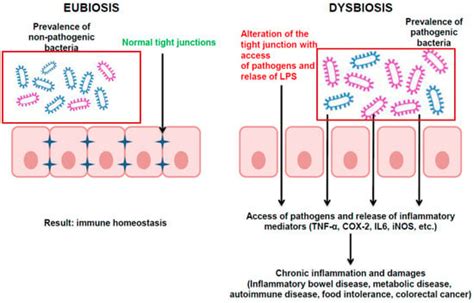 Probiotics Can Cure Oral Aphthous Like Ulcers In Inflammatory Bowel