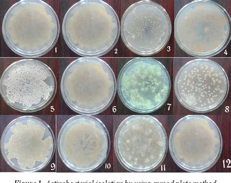 Figure 1 From Isolation Of Antibiotics Producing Actinobacteria From