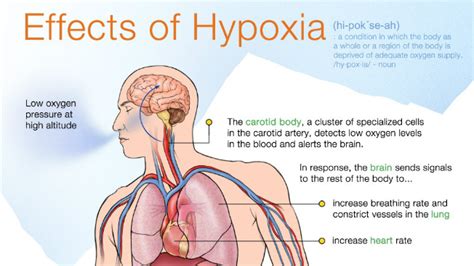 Brain Hypoxia & Oxygenation, Prevention And Treatment! - Veledora Fitness