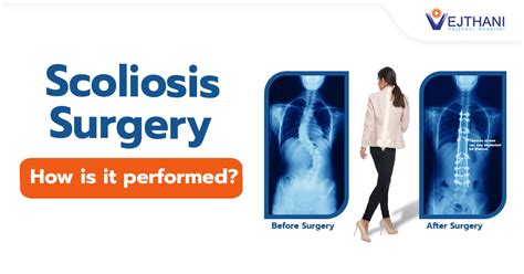 How Is Scoliosis Surgery Performed?