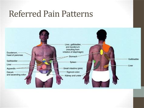 Visceral Referred Pain Patterns