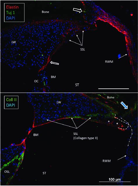 Confocal Immunohistochemistry Of The Human Cochlea At The Level Of The