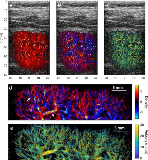 A Super Resolution Microvessel Density Image Of A Human Kidney