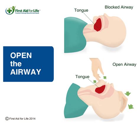 opentheairway-04 | Stay Safe for Older People