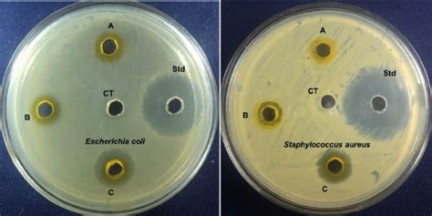 Antibacterial Activity Of Baicalein Against E Coli And S Aureus