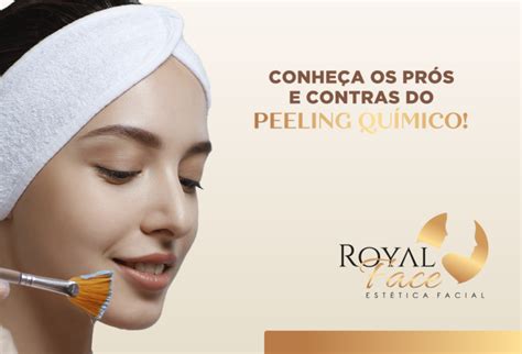 Conheça Os Prós E Contras Do Peeling Químico