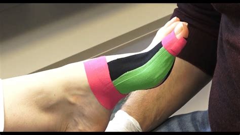 Podo Taping Concept Hallux rigidus Arthrose der Großen Zehe YouTube