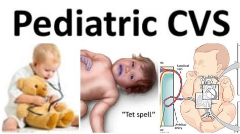 CVS Paediatrics 4 Tricuspid Atresia TOF YouTube