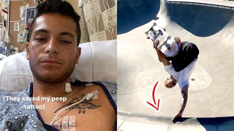 How Skateboarding And Open Heart Surgery Saved His Life Youtube