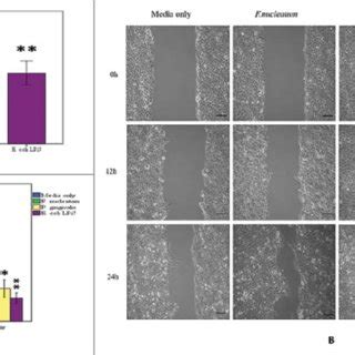 (A) Analysis of transwell migration assay for H400 cells stimulated ...