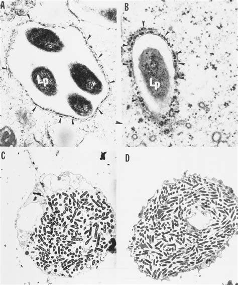 Transmission Electron Micrographs Of A Polyphaga Infected By The Download Scientific Diagram