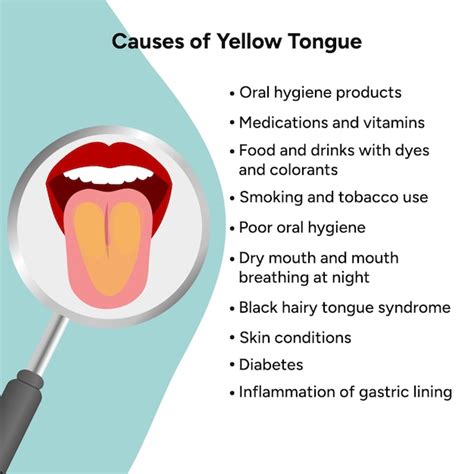 Premium Vector | Causes of yellow tongue